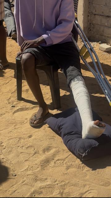 RUNDU, 13 July 2026 - Grade 10 learner Muyova Immanuel of Sarusungu Combined School in Rundu is one of the learners assaulted by police on Thursday  after a teacher's cellphone was reportedly stolen and later recovered. (Photo by: Sawi Hausiku) NAMPA 