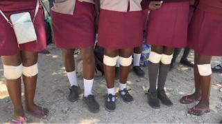 RUNDU, 03 October 2025- A picture of the injured six grade 8 girls at Katjinakatji Senior Secondary School. (Photo by: Sawi Hausiku) NAMPA 