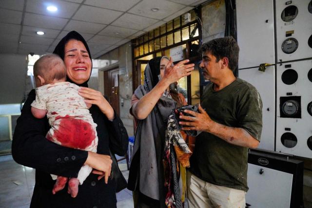 TOPSHOT - Iranians who were injured in a reported Israeli strike on Keshavarz Boulevard in downtown Tehran react at the site on June 15, 2025. Israel and Iran traded heavy fire for a third straight day on June 15, with mounting casualties and expanding targets marking a sharp escalation in hostilities between the longtime foes. (Photo by AMIR KHOLOUSI / ISNA / AFP)
