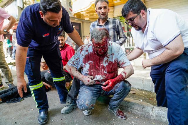 TOPSHOT - Iranian rescuers and passersby care for a man who was injured in a reported Israeli strike on Keshavarz Boulevard in downtown Tehran on June 15, 2025. Israel and Iran traded heavy fire for a third straight day on June 15, with mounting casualties and expanding targets marking a sharp escalation in hostilities between the longtime foes. (Photo by AMIR KHOLOUSI / ISNA / AFP)