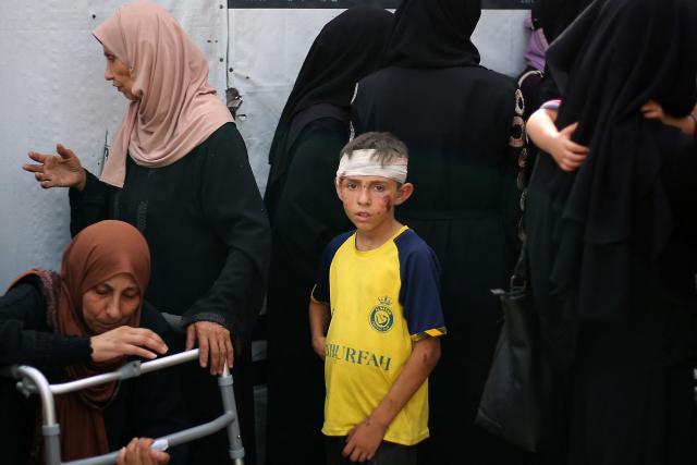 An injured Palestinian boy stands among mourners at the al-Aqsa Martyrs hospital in Deir el-Balah in the central Gaza Strip on July 1, 2025, following overnight Israeli strikes as the war between the Palestinian Hamas militant and Israel continues. (Photo by Eyad BABA / AFP)