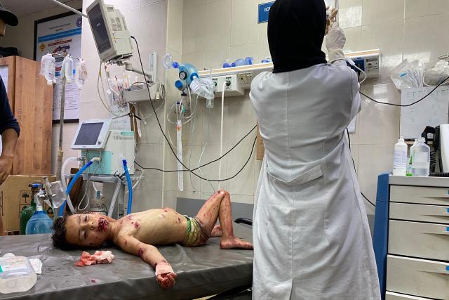 EDITORS NOTE: Graphic content / A girl receives treatment for her wounds, sustained in an Israeli strike on a camp housing displaced Palestinians, at Khan Yunis' Nasser hospital in the southern Gaza Strip on July 2, 2025. Israel's military said July 1, that it had expanded its operations in Gaza, where residents reported fierce gunfire and shelling days before a planned trip to Washington by Prime Minister Benjamin Netanyahu. (Photo by AFP)