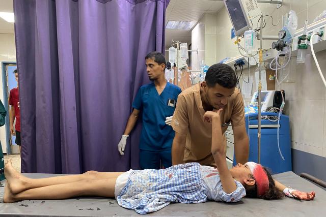 EDITORS NOTE: Graphic content / TOPSHOT - A girl gestures as she receives treatment for her wounds, sustained in an Israeli strike on a camp housing displaced Palestinians, at Khan Yunis' Nasser hospital in the southern Gaza Strip on July 2, 2025. Israel's military said July 1, that it had expanded its operations in Gaza, where residents reported fierce gunfire and shelling days before a planned trip to Washington by Prime Minister Benjamin Netanyahu. (Photo by AFP)