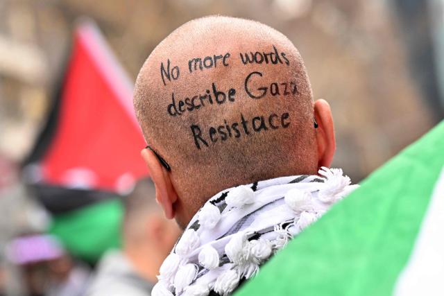 A man displays a slogan on his shaved head in a pro-Palestinian march through the streets in Melbourne on July 6, 2025, amid the ongoing conflict between Israel and the Palestinian Hamas militant group. (Photo by William WEST / AFP)
