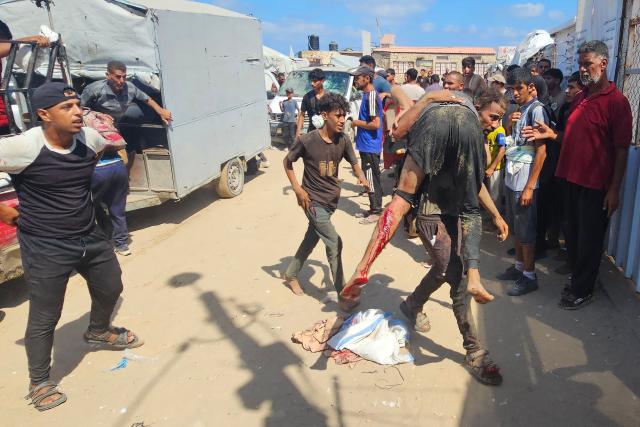 EDITORS NOTE: Graphic content / Palestinians transport a victim to a Red Cross clinic in Rafah in the southern Gaza Strip after they were reportedly shot as they waited to receive food parcels at a distribution point run by the US and Israel-backed Gaza Humanitarian Foundation (GHF), on July 12, 2025. Gaza's civil defence agency said at least 14 Palestinians were killed in the latest wave of Israeli strikes across the territory on July 12. (Photo by AFP)
