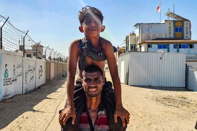 EDITORS NOTE: Graphic content / A Palestinian man transports a young victim to a Red Cross clinic in Rafah in the southern Gaza Strip after he was reportedly shot as they waited to receive food parcels at a distribution point run by the US and Israel-backed Gaza Humanitarian Foundation (GHF), on July 12, 2025. Gaza's civil defence agency said at least 14 Palestinians were killed in the latest wave of Israeli strikes across the territory on July 12. (Photo by AFP)