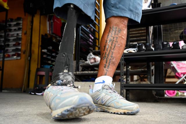 A man with a prosthetic leg stands near the Zona Belen market in Tegucigalpa on September 18, 2025. (Photo by Orlando SIERRA / AFP)