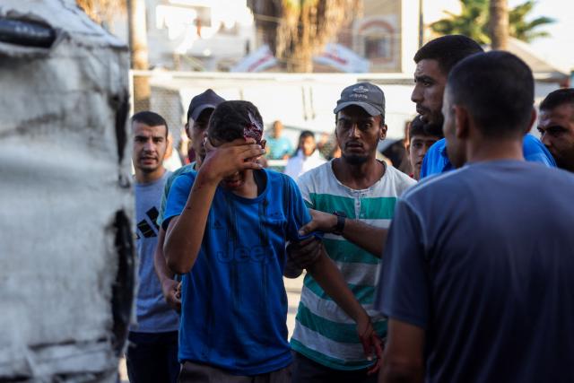 Palestinians help a youth who was injured in a reported Israeli drone attack in Deir al-Balah, into Al-Aqsa Martyrs Hospital in the central Gaza Strip on October 2, 2025. Israel's defence minister issued a final warning for residents in Gaza City to flee south on October 1, as the Palestinian Hamas movement weighed the latest US plan to end the war in the besieged Palestinian territory. (Photo by BASHAR TALEB / AFP)