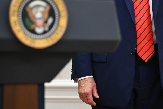 US President Donald Trump's right hand is seen after he announced a deal on drug pricing at the Oval Office of the White House in Washington, DC, on October 10, 2025. Trump announced a lowering in drug prices with a deal with drug maker AstraZeneca. (Photo by SAUL LOEB / AFP)