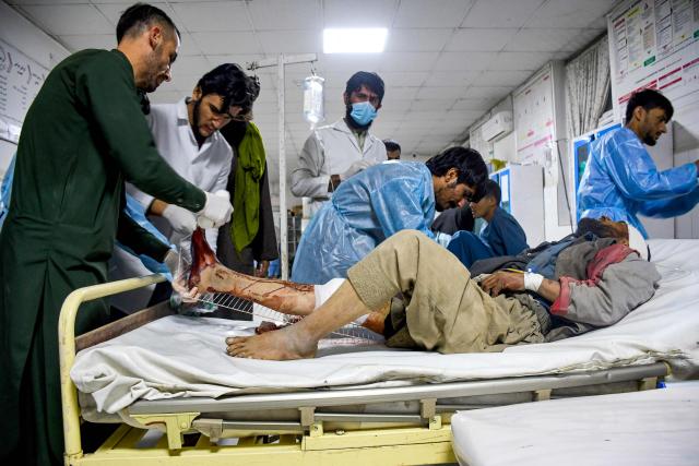 Afghan medical personnel treat a wounded man at a hospital in the aftermath of an earthquake, that struck overnight in Mazar-i-Sharif on November 3, 2025. A 6.3-magnitude strong earthquake killed at least nine people in northern Afghanistan, authorities said on November 3, just months after another deadly tremor left the country reeling. (Photo by Atif Aryan / AFP)