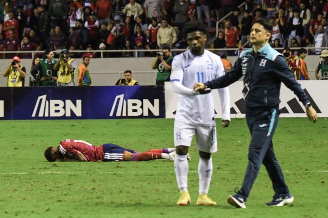 Costa Rica's midfielder #14 Orlando Galo reacts after the 2026 FIFA World Cup Concacaf qualifier football match between Costa Rica and Honduras at the National Stadium in San Jose on November 18, 2025. (Photo by EZEQUIEL BECERRA / AFP)