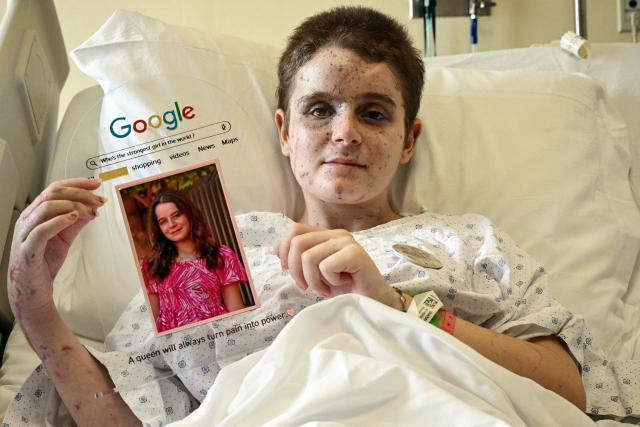 EDITORS NOTE: Graphic content / Thirteen-year-old Lebanese teenager Aseel, daughter of Amani Bazzi, poses on November 25, 2025, at a hospital in Beirut with a portrait of herself taken before she was gravely wounded in an Israeli military strike in the southern Lebanese town of Bint Jbeil. In one afternoon, Amani Bazzi went from being a doting mother-of-four to a widow grieving three young children. An Israeli strike in south Lebanon killed them as the family was returning home after having lunch with her parents. (Photo by Joseph EID / AFP)