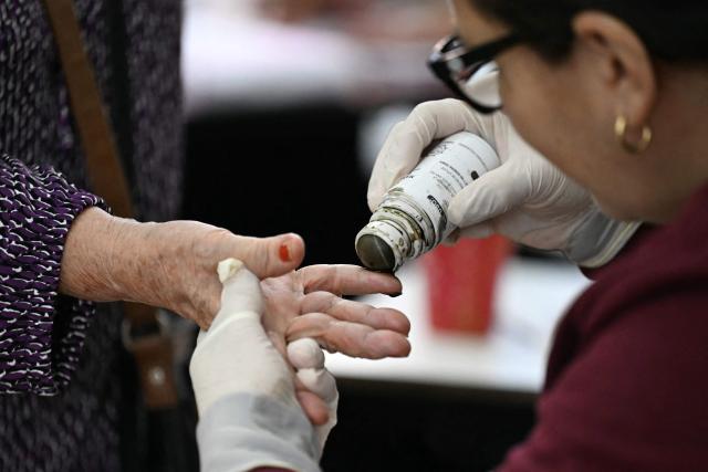 A woman has her fingers inked at a polling station during Honduras' general election in Tegucigalpa on November 30, 2025. (Photo by Marvin RECINOS / AFP)