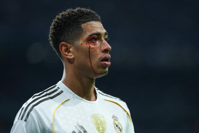 Blood runs down the face of Real Madrid's English midfielder #05 Jude Bellingham after he was injured during the Spanish league football match between Real Madrid CF and RC Celta de Vigo at the Santiago Bernabeu Stadium in Madrid on December 7, 2025. (Photo by Thomas COEX / AFP)