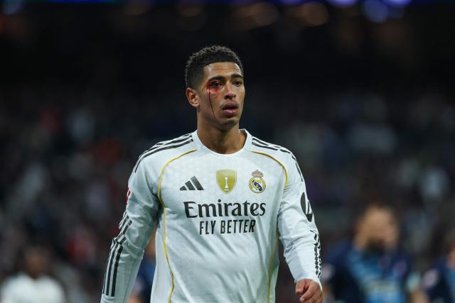Blood runs down the face of Real Madrid's English midfielder #05 Jude Bellingham after he was injured during the Spanish league football match between Real Madrid CF and RC Celta de Vigo at the Santiago Bernabeu Stadium in Madrid on December 7, 2025. (Photo by Thomas COEX / AFP)