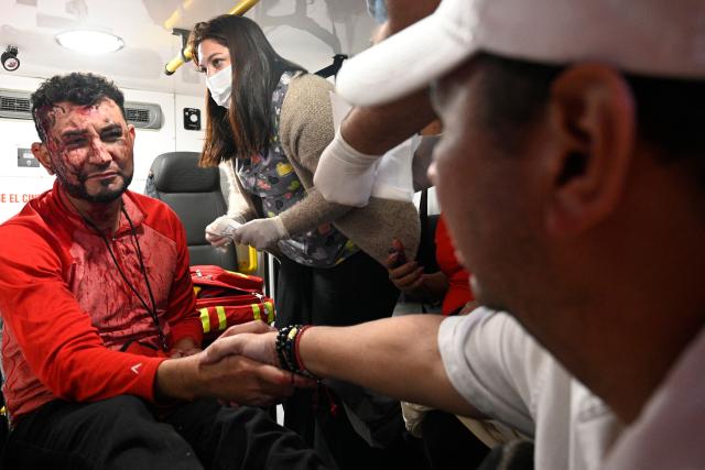 Tegucigalpa's Mayor Jorge Aldana greets a supporter who was injured during an eviction by the National Civil Police and the Military Police of Public Order (PMOP) in the surroundings of the National Institute of Professional Training (INFOP), where the National Electoral Council (CNE) will carry out the scrutiny, after the vote count was interrupted several times due to computer failures, in Tegucigalpa on December 16, 2025. At least eight people were injured on Monday night during an operation to remove left-wing militants who were pressing for the final results of the general elections in Honduras, authorities reported on Tuesday. More than two weeks after the elections, Hondurans still do not know the winner of the presidential race or other elected officials in positions such as mayor of the capital, Tegucigalpa. (Photo by Orlando SIERRA / AFP)