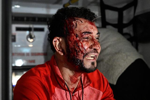 A supporter who was injured during an eviction by the National Civil Police and the Military Police of Public Order (PMOP), is assisted at an ambulance in the surroundings of the National Institute of Professional Training (INFOP), where the National Electoral Council (CNE) will carry out the scrutiny, after the vote count was interrupted several times due to computer failures, in Tegucigalpa on December 16, 2025. At least eight people were injured on Monday night during an operation to remove left-wing militants who were pressing for the final results of the general elections in Honduras, authorities reported on Tuesday. More than two weeks after the elections, Hondurans still do not know the winner of the presidential race or other elected officials in positions such as mayor of the capital, Tegucigalpa. (Photo by Orlando SIERRA / AFP)