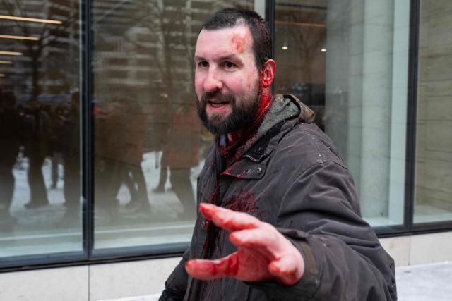 A bloodied ICE supporter tries to avoid a crowd of anti-ICE protesters after he and two other ICE supporters were attacked by a flag pole after an “Americans Against Islamification” rally near City Hall in Minneapolis, Minnesota on January 17, 2026. The anti-Islamic rally began at Minneapolis City Hall and planned to end in an area of high Somali population. (Photo by ROBERTO SCHMIDT / AFP)