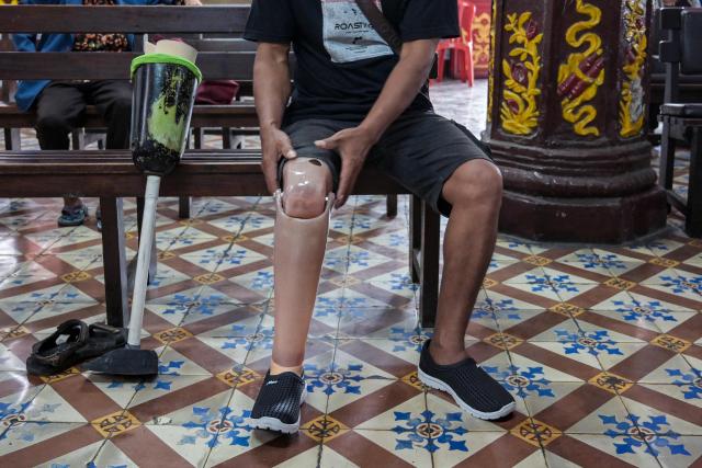 A man waits to receive a prosthetic leg, distributed for free to people with physical disabilities as part of a social service event by a Chinese foundation, at the Boen Bio Temple in Surabaya on January 18, 2026. (Photo by Juni KRISWANTO / AFP)