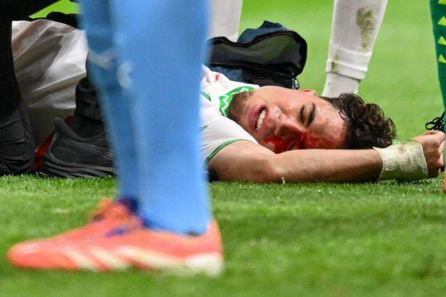 Morocco's midfielder #24 Neil El Aynaoui bleeds during the Africa Cup of Nations (CAN) final football match between Senegal and Morocco at the Prince Moulay Abdellah Stadium in Rabat on January 18, 2026. (Photo by SEBASTIEN BOZON / AFP)