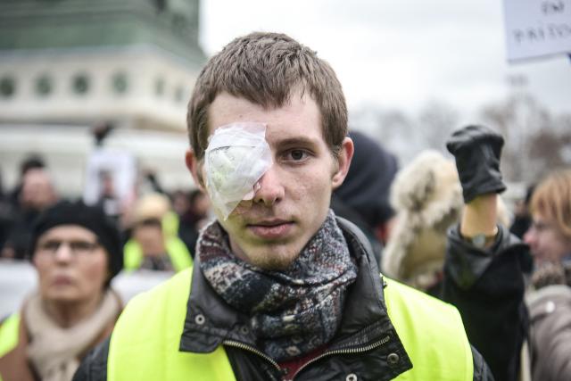 (FILES) Franck Didron, a "yellow vest" (gilets jaunes) protester who claims to have been hit in the eye by a rubber defensive ball when police charged the crowd during a protest on December 1, 2018, poses for a photograph ahead of a demonstration called by the "yellow vest" movement in the capital on February 2, 2019. Investigations have failed to identify the police officer who fired the LBD that cost ‘yellow vest’ protester Franck Didron his right eye during a demonstration in 2018, and the case has been dismissed, AFP learned on January 27, 2026 from a source close to the investigation. (Photo by LUCAS BARIOULET / AFP)
