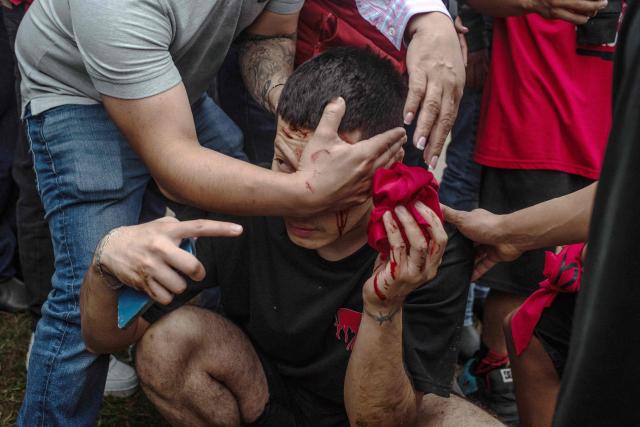 An injured young man is assisted after an encounter with a bull during the traditional bull run held as part of the Candelaria festivities in Tlacotalpan, Veracruz state, Mexico, on February 1, 2026. During the celebration, townspeople run after and taunt bulls through the streets. (Photo by Hector QUINTANAR / AFP)