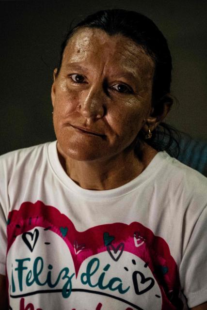 Huntington’s patient Ana Maria poses for a picture during a medical examination at a volunteer medical clinic in the neighborhood of San Luis in Maracaibo, Zulia state, Venezuela, on January 30, 2026. The Lake Maracaibo region in Venezuela holds the world’s highest concentration of Huntington’s disease (HD), with a prevalence of roughly 700 per 100,000 in certain areas. (Photo by Maryorin Mendez / AFP)