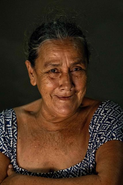 Huntington’s patient Ninoska Soto poses for a picture during a medical examination at a volunteer medical clinic in the neighborhood of San Luis in Maracaibo, Zulia state, Venezuela, on January 30, 2026. The Lake Maracaibo region in Venezuela holds the world’s highest concentration of Huntington’s disease (HD), with a prevalence of roughly 700 per 100,000 in certain areas. (Photo by Maryorin Mendez / AFP)