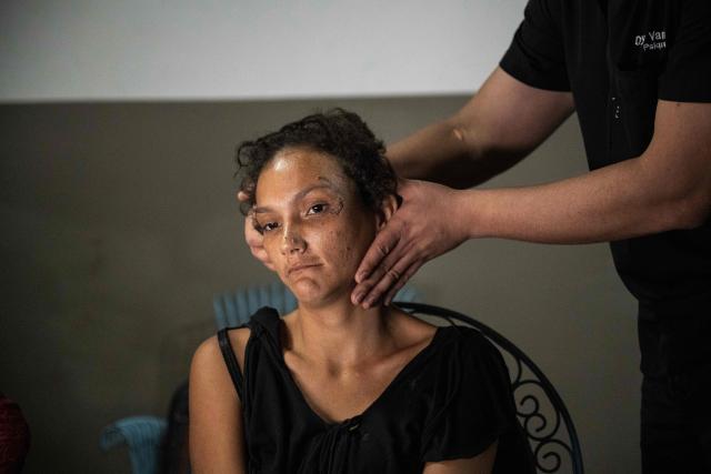 A Huntington’s patient is checked by a physician at a volunteer medical clinic in the neighborhood of San Luis in Maracaibo, Zulia state, Venezuela, on January 30, 2026. The Lake Maracaibo region in Venezuela holds the world’s highest concentration of Huntington’s disease (HD), with a prevalence of roughly 700 per 100,000 in certain areas. (Photo by Maryorin Mendez / AFP)