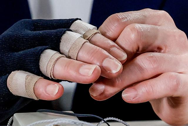 This photograph shows the injured hand of Japan's Prime Minister and President of the Liberal Democratic Party (LDP), Sanae Takaichi, as she speaks with media on the House of Representatives election day at the LDP headquarters in Tokyo on February 8, 2026. (Photo by Kim Kyung-Hoon / POOL / AFP)