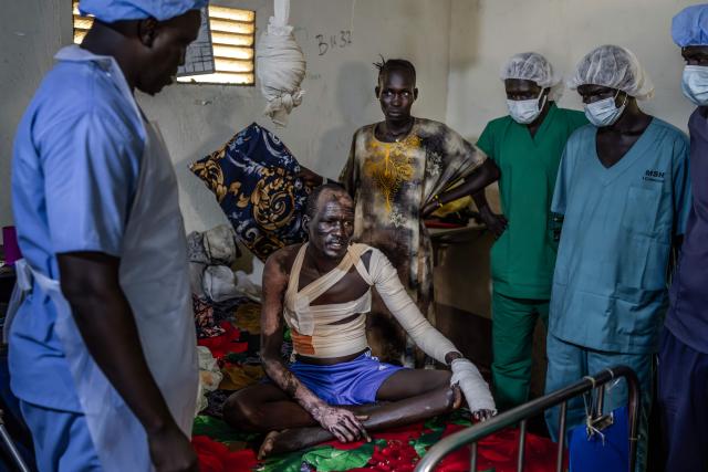 Medical personnel check on Tot Khor, 41, (C) as he sits on a bed recovering from burns sustained during clashes between the South Sudan People’s Defence Forces (SSPDF) and the South Sudan People’s Liberation Army in Opposition (SPLA-IO) at Akobo Teaching Hospital in the strategic opposition-controlled town of Akobo, Jonglei State, on February 12, 2026. South Sudan gained independence in 2011 but quickly descended into civil war between rival generals, Salva Kiir and Riek Machar. A power-sharing deal in 2018 brought relative peace, with Kiir as president and Machar his deputy. But the deal was never fully implemented, their forces never unified, and elections never held. Over the past year, Machar has been jailed and violence has erupted between their forces in several areas. The worst has been in Jonglei state, where some 280,000 people have been displaced since December, according to the United Nations. (Photo by Luis TATO / AFP)
