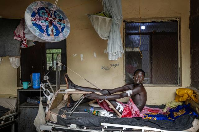 Chuol Manyal sits on a bed recovering from gunshot wounds sustained during clashes between the South Sudan People’s Defence Forces (SSPDF) and the South Sudan People’s Liberation Army in Opposition (SPLA-IO) at Akobo Teaching Hospital in the strategic opposition-controlled town of Akobo, Jonglei State, on February 12, 2026. South Sudan gained independence in 2011 but quickly descended into civil war between rival generals, Salva Kiir and Riek Machar. A power-sharing deal in 2018 brought relative peace, with Kiir as president and Machar his deputy. But the deal was never fully implemented, their forces never unified, and elections never held. Over the past year, Machar has been jailed and violence has erupted between their forces in several areas. The worst has been in Jonglei state, where some 280,000 people have been displaced since December, according to the United Nations. (Photo by Luis TATO / AFP)