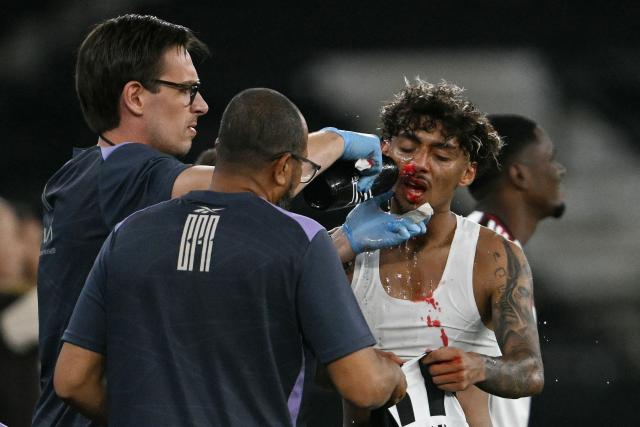 Botafogo's Argentine midfielder #06 Cristian Medina receives medical attention for bleeding during the Brazilian Championship Serie A football match between Botafogo and Flamengo at the Nilton Santos Stadium in Rio de Janeiro, Brazil on March 14, 2026. (Photo by MAURO PIMENTEL / AFP)
