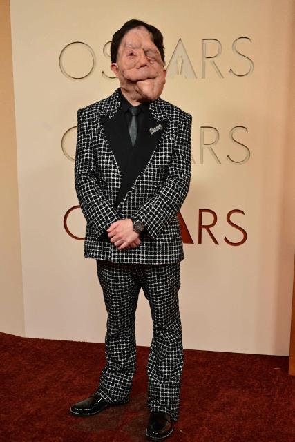 British actor and TV show host Adam Pearson attends the 98th Annual Academy Awards at the Dolby Theatre in Hollywood, California on March 15, 2026. (Photo by Frederic J. Brown / AFP)