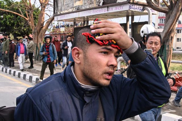 A supporter of Nepal's former prime minister Khadga Prasad Sharma Oli, suffers an injury after clashing with police during a protest against Oli's arrest in Kathmandu on March 29, 2026. Oli appeared in court via video-link from a hospital on March 29 after his arrest for his alleged role in a deadly crackdown on the 2025 protests that ousted him. (Photo by Prakash MATHEMA / AFP)