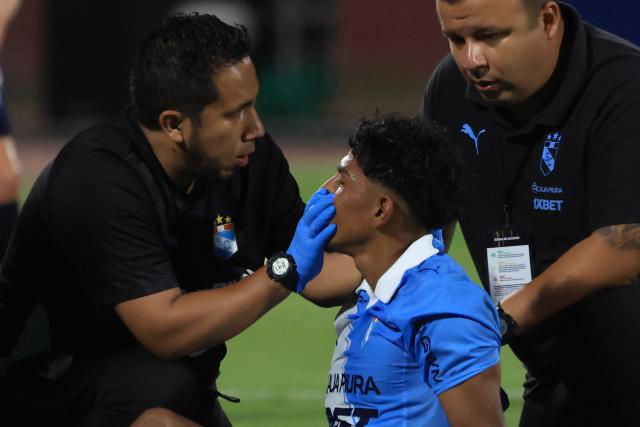 Sporting Cristal's forward #23 Maxloren Castro receives medical attention during the Copa Libertadores group stage football match between Peru's Sporting Cristal and Paraguay's Cerro Porteno at the Nacional stadium in Lima, on April 8, 2026. (Photo by Connie FRANCE / AFP)