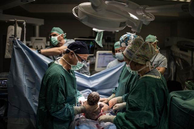 Israeli doctor Reuven Kedar (L), the Director of the Maternal-Fetal Medicine Unit, delivers the third baby of Sarah Bird, an Israeli woman at the operating theatre of the neonatal unit in the underground bomb shelter built into the Carmel Medical Center in the northern city of Haifa, on April 9, 2026. The hospital, built in the tip of the one of the mountains of the Carmel Mountain Range is part of the Clalit Health Services, the largest health organisation in Israel running 14 hospitals across the country. At least 14 rocket alerts sounded through April 9 morning in communities near Israel's northern border with Lebanon as Israeli forces fight Hezbollah despite the US-Iran ceasefire. (Photo by MARCO LONGARI / AFP)