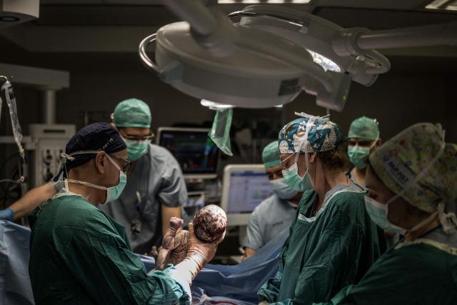 Israeli doctor Reuven Kedar (L), the Director of the Maternal-Fetal Medicine Unit, delivers the third baby of Israeli woman Sarah Bird at the operating theatre of the neonatal unit in the underground bomb shelter built into the Carmel Medical Center in the northern city of Haifa, on April 9, 2026. The hospital, built in the tip of the one of the mountains of the Carmel Mountain Range is part of the Clalit Health Services, the largest health organisation in Israel running 14 hospitals across the country. At least 14 rocket alerts sounded through April 9 morning in communities near Israel's northern border with Lebanon as Israeli forces fight Hezbollah despite the US-Iran ceasefire. (Photo by MARCO LONGARI / AFP)