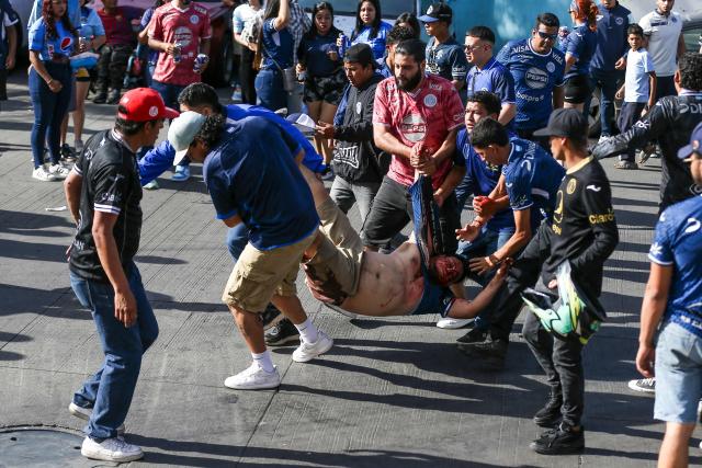 Motagua fans carry an injured person to receive medical attention following clashes between members of Olimpia’s Ultrafiel and Motagua’s Mega Locos fan groups outside the Chelato Ucles National Stadium in Tegucigalpa on April 12, 2026. (Photo by JOHNY MAGALLANES / AFP)