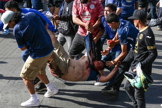 Motagua fans carry an injured person to receive medical attention following clashes between members of Olimpia’s Ultrafiel and Motagua’s Mega Locos fan groups outside the Chelato Ucles National Stadium in Tegucigalpa on April 12, 2026. (Photo by JOHNY MAGALLANES / AFP)
