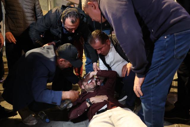 A protestor gets help after being spayed with pepper spray during clashes with Albanian riot police in a anti-government protest in Tirana on April 17, 2026. (Photo by Adnan Beci / AFP)