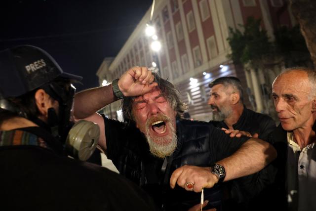 A press photographer reacts after being sprayed with pepper spray by Albanian riot police during an anti-government protest in Tirana on April 17, 2026. (Photo by Adnan Beci / AFP)