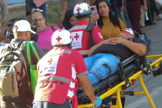 EDITORS NOTE: Graphic content / Red Cross personnel carry an injured demonstrator during a protest against budget cuts to university education near the National Congress in Tegucigalpa on April 20, 2026. (Photo by Johny MAGALLANES / AFP)