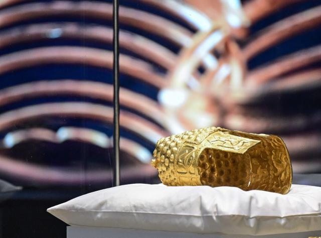 The ancient Cotofenesti helmet and two Dacian gold bracelets are on display at the National Museum of History of Romania (MNIR) in Bucharest on April 21, 2026. The artifacts, shown together for the first time since their repatriation, are part of a national campaign to bring Romania’s most significant ancient treasures to the public across the country. In January 2025, the Cotofenesti helmet and several gold bracelets were stolen from the Drents Museum in Assen, Netherlands. They were on loan from the National Museum of History of Romania (MNIR) as part of the "Dacia – Empire of Gold and Silver" exhibition. (Photo by Daniel MIHAILESCU / AFP)