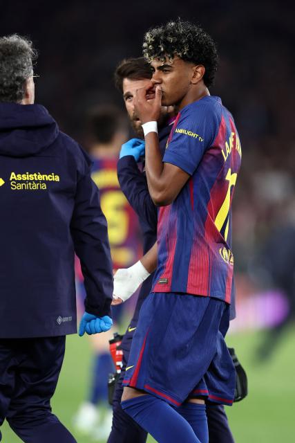 Barcelona's Spanish forward #10 Lamine Yamal leaves the pitch after sustaining an injury during the Spanish league football match between FC Barcelona and RC Celta de Vigo at Camp Nou stadium in Barcelona on April 22 , 2026. (Photo by Josep LAGO / AFP)