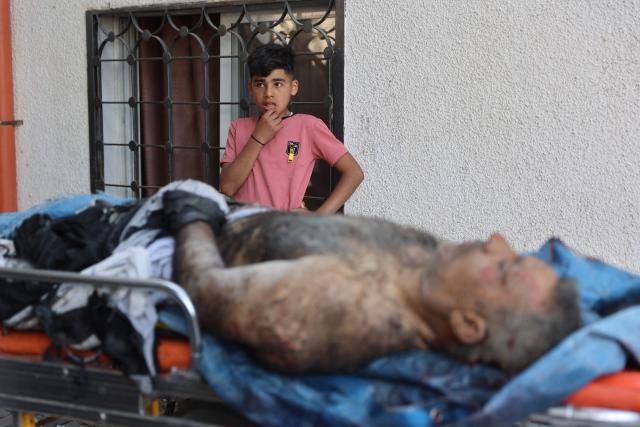 EDITORS NOTE: Graphic content / A young Palestinian boy looks on as the body of 57-year-old Eyad al-Matouq lies on a gurney at the Gaza City al-Shifa Hospital, after he was killed when he was reportedly targeted by an Israeli reconnaissance aircraft while riding an electric bicycle in the Jabalia refugee camp in the northern Gaza Strip on May 9, 2026, The war was sparked by Hamas's October 7, 2023 attack on Israel, which resulted in the deaths of 1,221 people. Israel's retaliatory assault on Gaza has killed at least 72,736 people, according to figures from the health ministry that the UN considers reliable. (Photo by Omar AL-QATTAA / AFP)