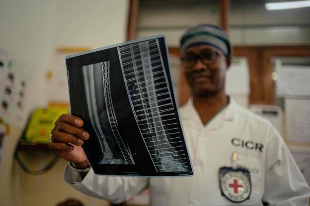 Doctor Soumah Sekou Amadou, a senior surgeon working with the International Committee of the Red Cross (ICRC), reviews a patient’s X-ray in the operating room at a hospital in Goma on May 14, 2026. (Photo by Jospin Mwisha / AFP)
