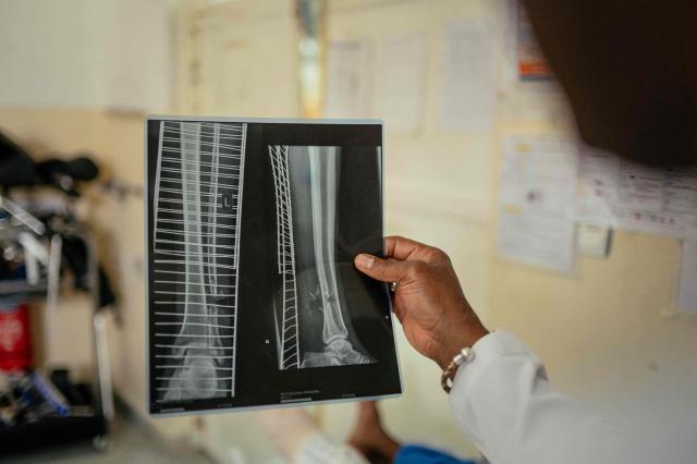 TOPSHOT - Doctor Soumah Sekou Amadou, a senior surgeon working with the International Committee of the Red Cross (ICRC), reviews a patient’s X-ray in the operating room at a hospital in Goma on May 14, 2026. (Photo by Jospin Mwisha / AFP)