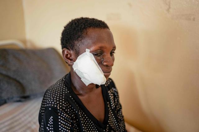 Mahoro Uwimana, 40, poses for a photograph at a ward in the International Committee of the Red Cross (ICRC) supported CBCA Hospital in Goma on May 14, 2026. She was shot in the face and now suffers from hearing problems and dental pain. (Photo by Jospin Mwisha / AFP)