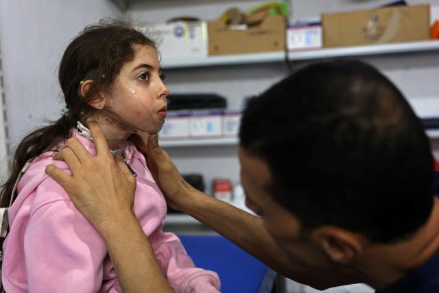 A technician works on a 3D-printed transparent facemask to treat burns of a Palestinian girl affected by the war at a clinic run by the Doctors Without Borders or Medecins Sans Frontieres (MSF) in Gaza City on May 17, 2026. Prime Minister Benjamin Netanyahu said on May 17 that Israel had almost completed a key goal of the war in Gaza -- eliminating all those responsible for orchestrating the October 7 attacks. (Photo by Omar AL-QATTAA / AFP)
